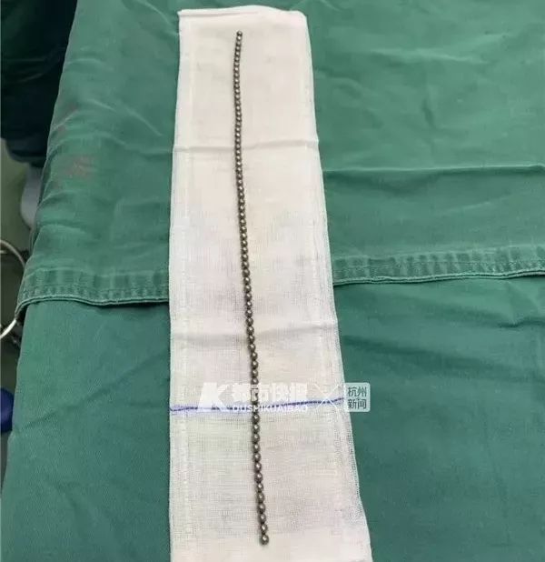 丁丁里塞进了70颗*珠钢**！家长们都该了解一下“儿童*慰自**”……