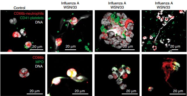 《自然》子刊：“吃货”血小板！科学家发现血小板能吞噬血液中的流感病毒，促进NET释放，或为流感增加心梗风险原因丨科学大发现