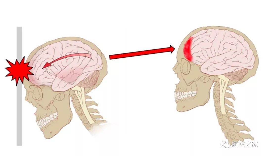 如何在空难中幸存,空难如何生还的案例