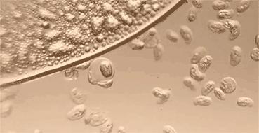 女士有妇科病建议穿什么裤,阴道炎能穿蚕丝抗菌裤吗