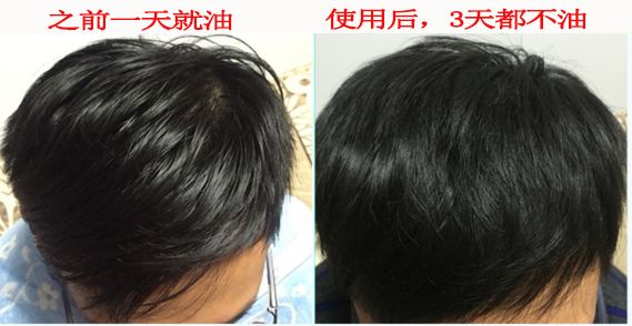 超短发细软塌怎么打理,拯救发量理发