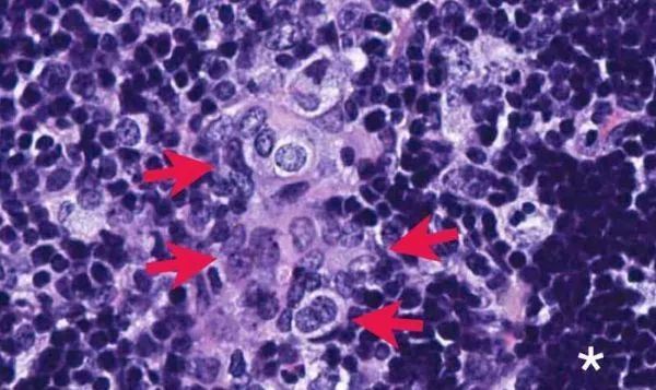 每日医健大事——2019年5月18日