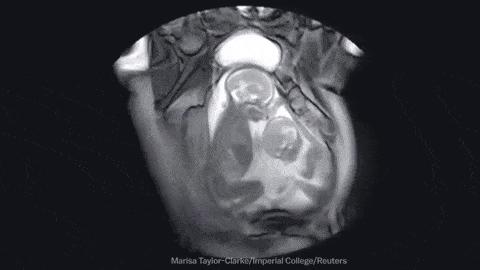 农场里走出CT鼻祖，美苏核危机诞生磁共振！