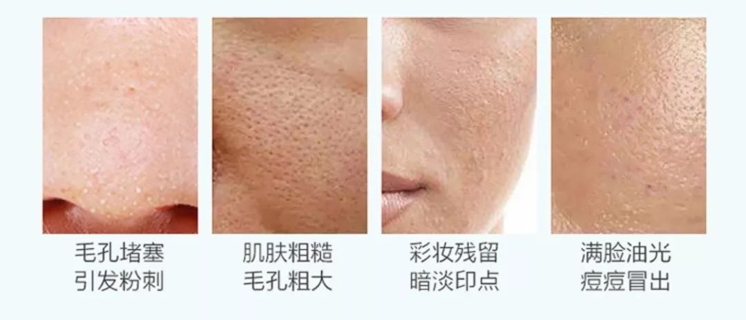 脸不干净有啥洗面奶好用,脸洗不干净用的护肤品