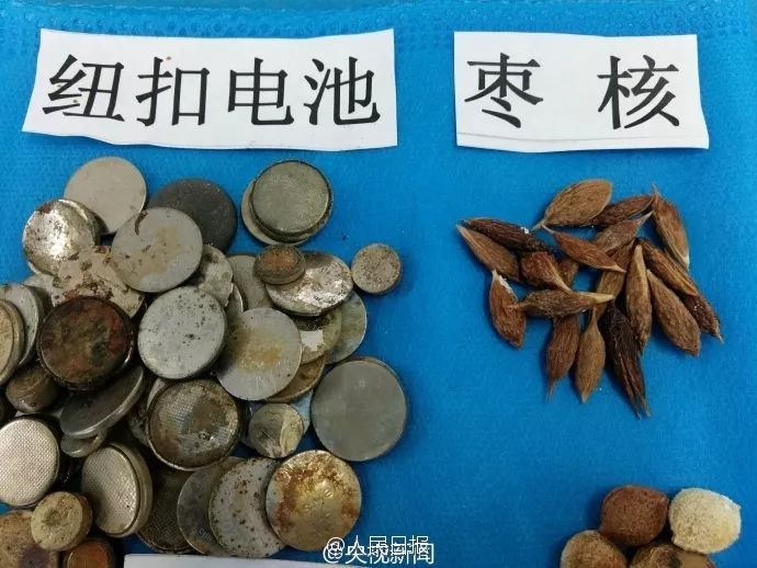 孩子呼吸出来一股恶臭味,三岁女童身体散发臭味真相