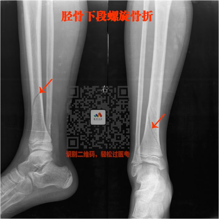执医技能：X线阅片，全是套路，超简单