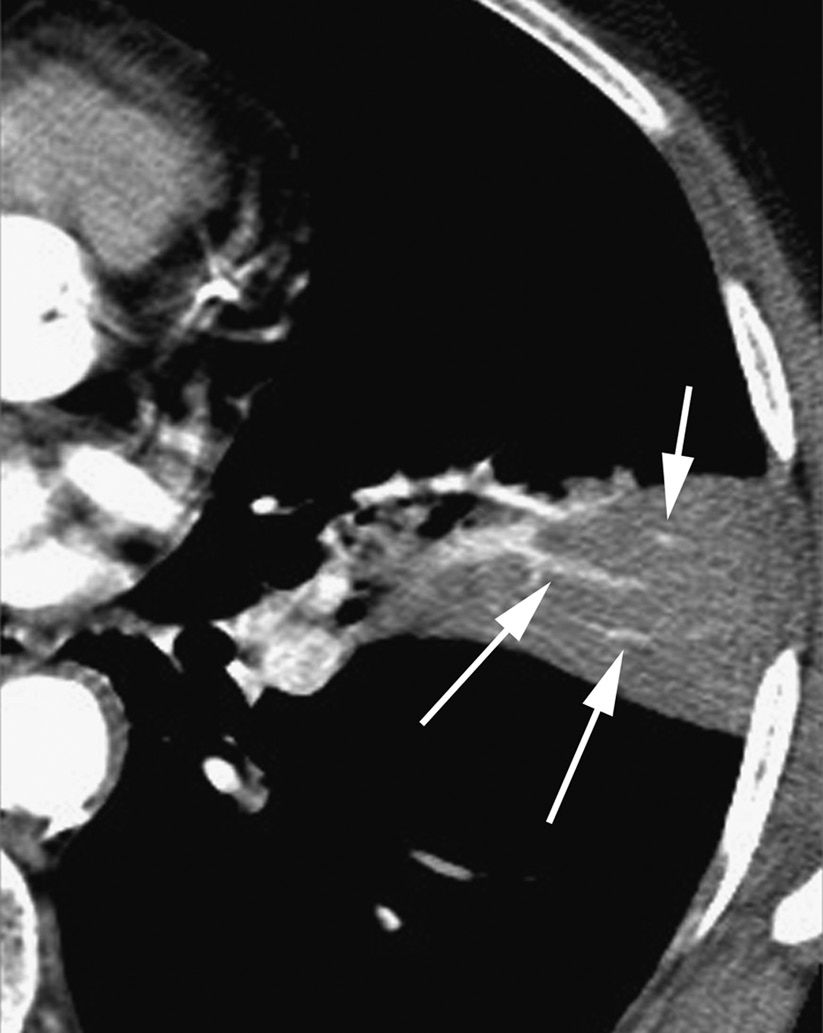 认识肺部的目的,认识呼吸器官知识点
