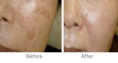 夏天被粉红色泡泡承包，嫁给爱情的女孩脸上都挂着糖霜