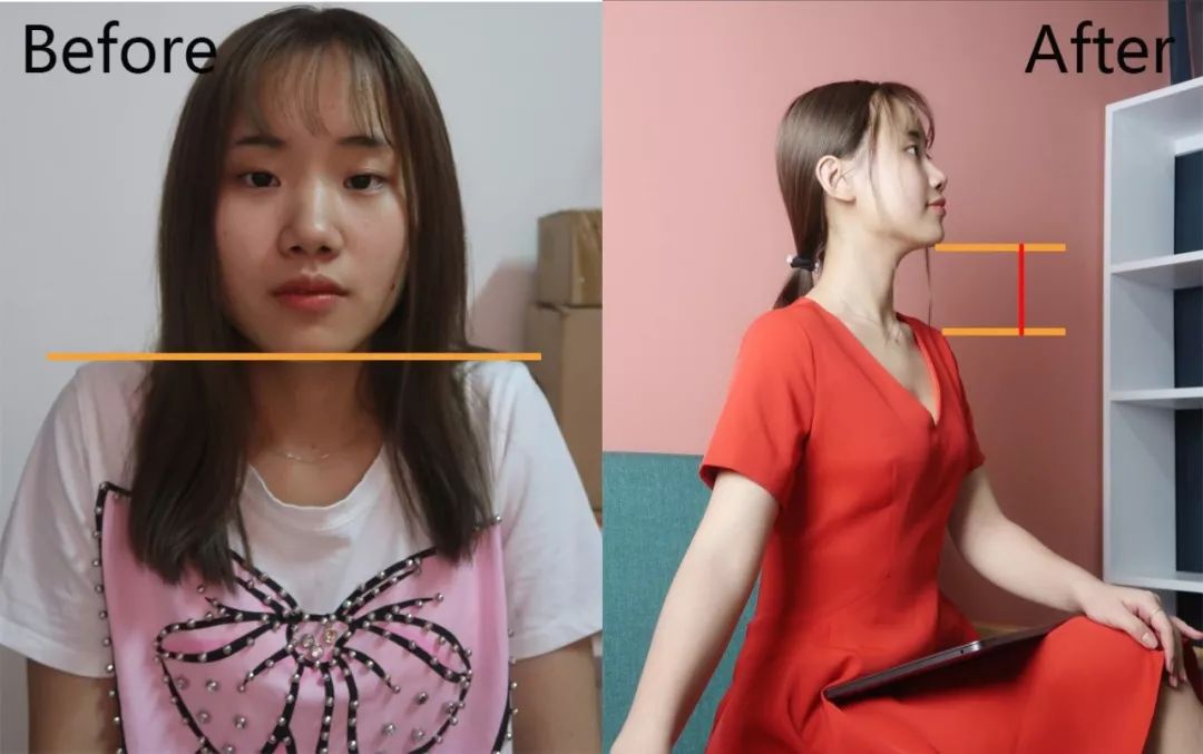 天鹅颈锁骨怎么练快速明显,天鹅颈的修炼方法视频