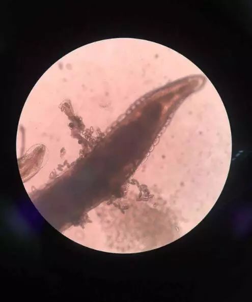 4岁小女孩老喊屁屁痒，妈妈查看后惊呆：许多小虫子！还在动