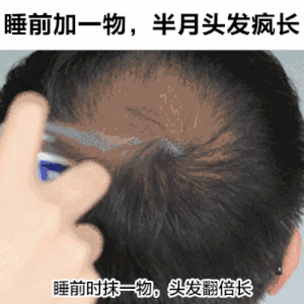 “本宝宝”“小姐姐”满天飞，你起鸡皮疙瘩了吗