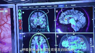 打呼噜其实是一种病,打呼噜是一种病吗有药可治吗