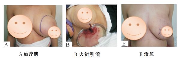 杏林宝鉴产后排残乳吗,杏林宝鉴中成药