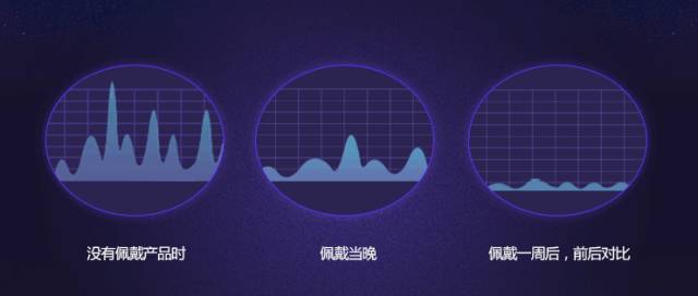智能止鼾神器防止打呼噜超声波,智能止鼾器治疗打鼾