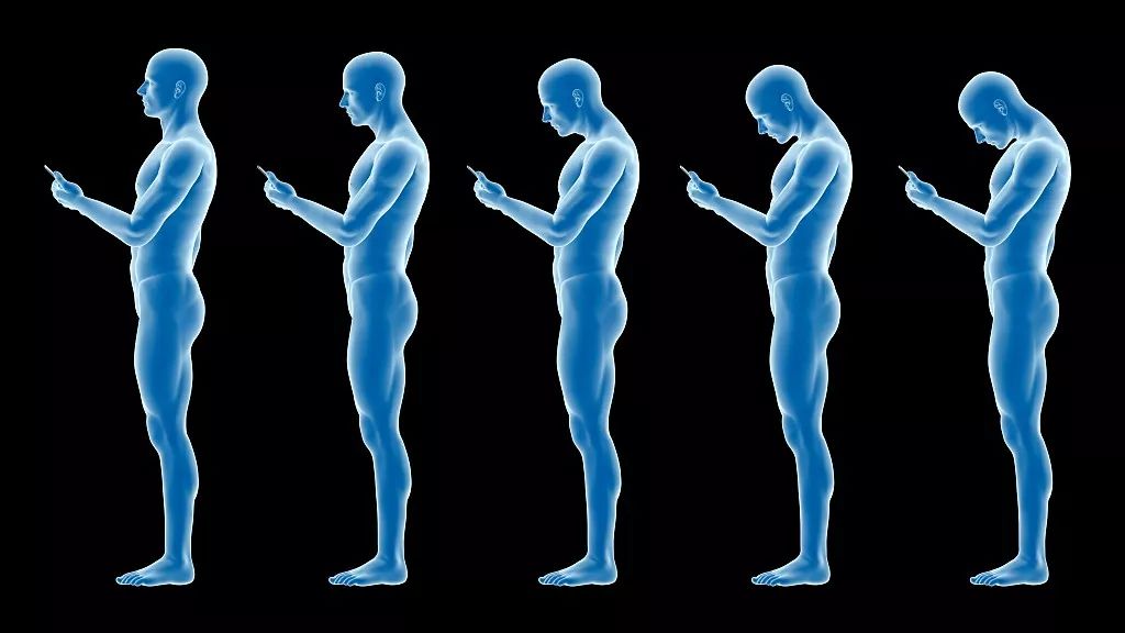 玩手机改变骨盆前倾,玩手机改变面貌有多大