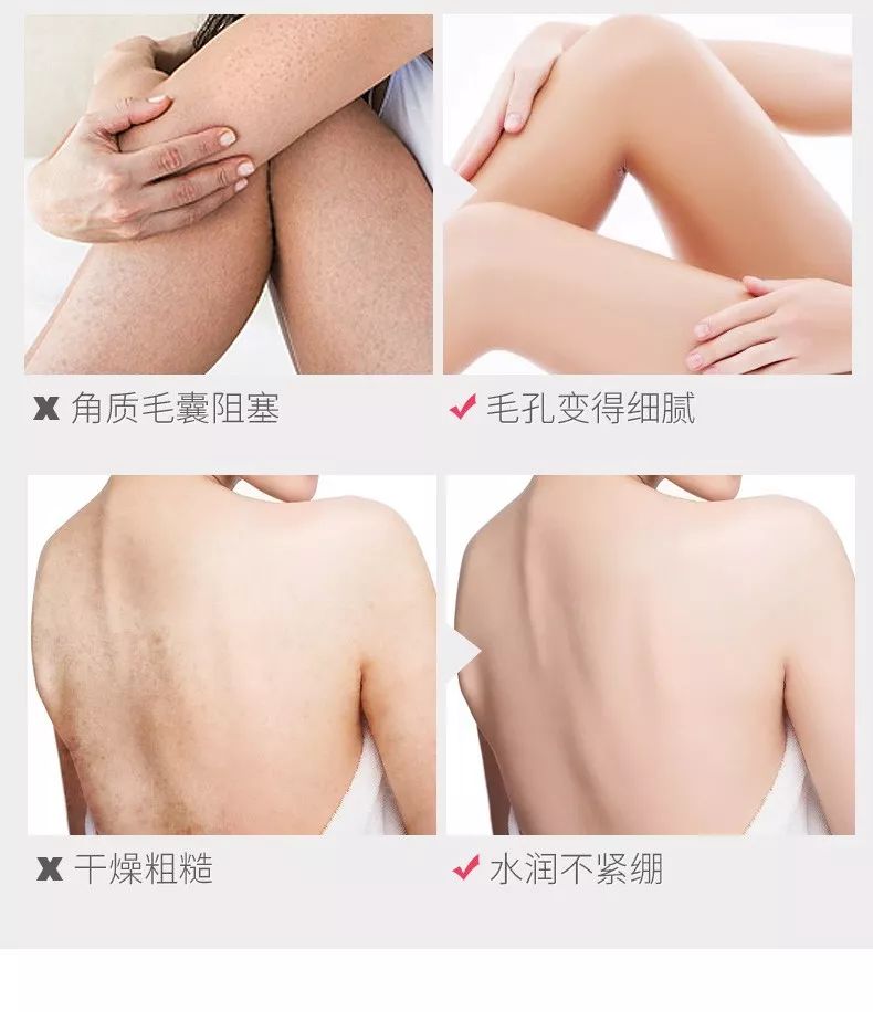 教你1分钟清除99%的脸上螨虫,10秒祛螨虫的药膏