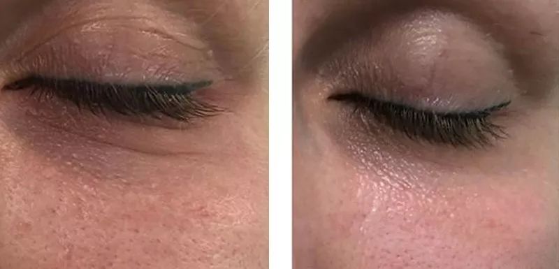 又是激凸又是露底，“蜜桃肌”的盛世美颜也有翻车时