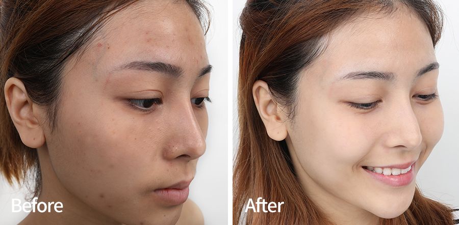 国货之光日本抢购,国货之光美妆面膜