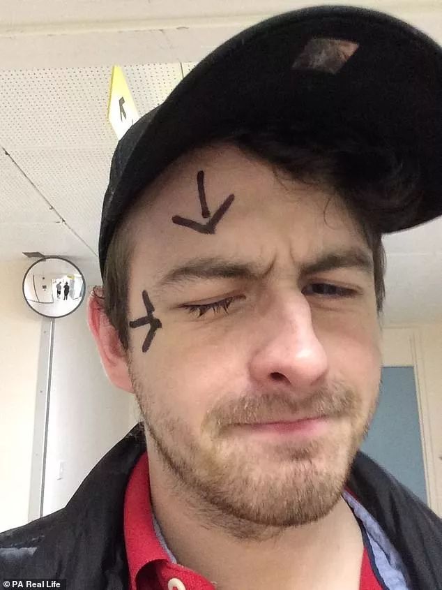 戴隐形眼镜有多可怕,戴隐形眼镜眼睛里长虫子