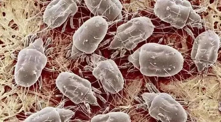 160万只螨虫的克星,4000多条螨虫