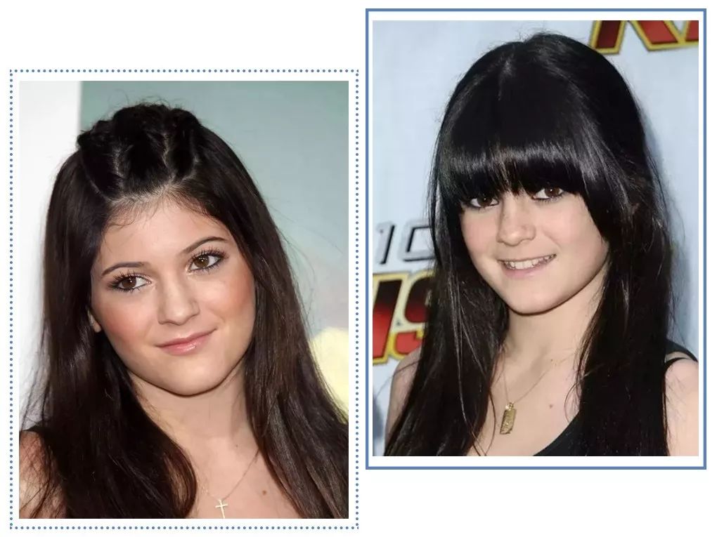 泫雅丰唇后颜值下跌?!但大家都爱这样的“香肠嘴”啊