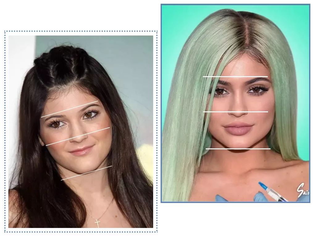 泫雅丰唇后颜值下跌?!但大家都爱这样的“香肠嘴”啊