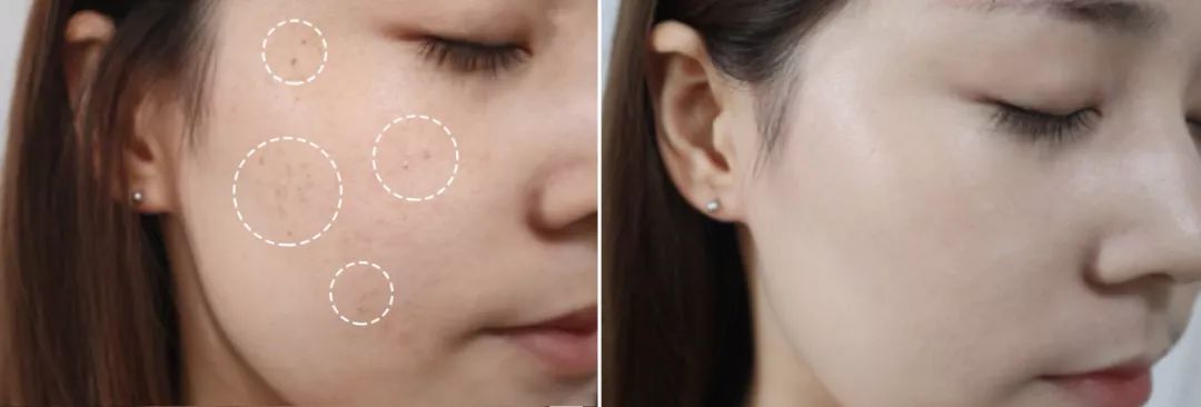 黑科技一秒祛斑,黑科技美白真的有效吗