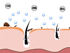 黑头用黑头膏为什么去不掉黑头,清洁黑头推荐用黑头仪还是黑头铲