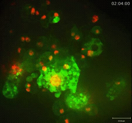 人体脂肪能卖钱吗,人体脂肪摄入