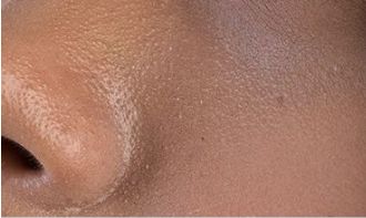 脸上搓出3斤泥！难怪又黄又暗又黑头！10秒给脸蛋“剥壳”，厉害