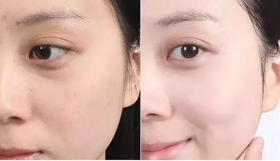 脸上搓出3斤泥！难怪又黄又暗又黑头！10秒给脸蛋“剥壳”，厉害