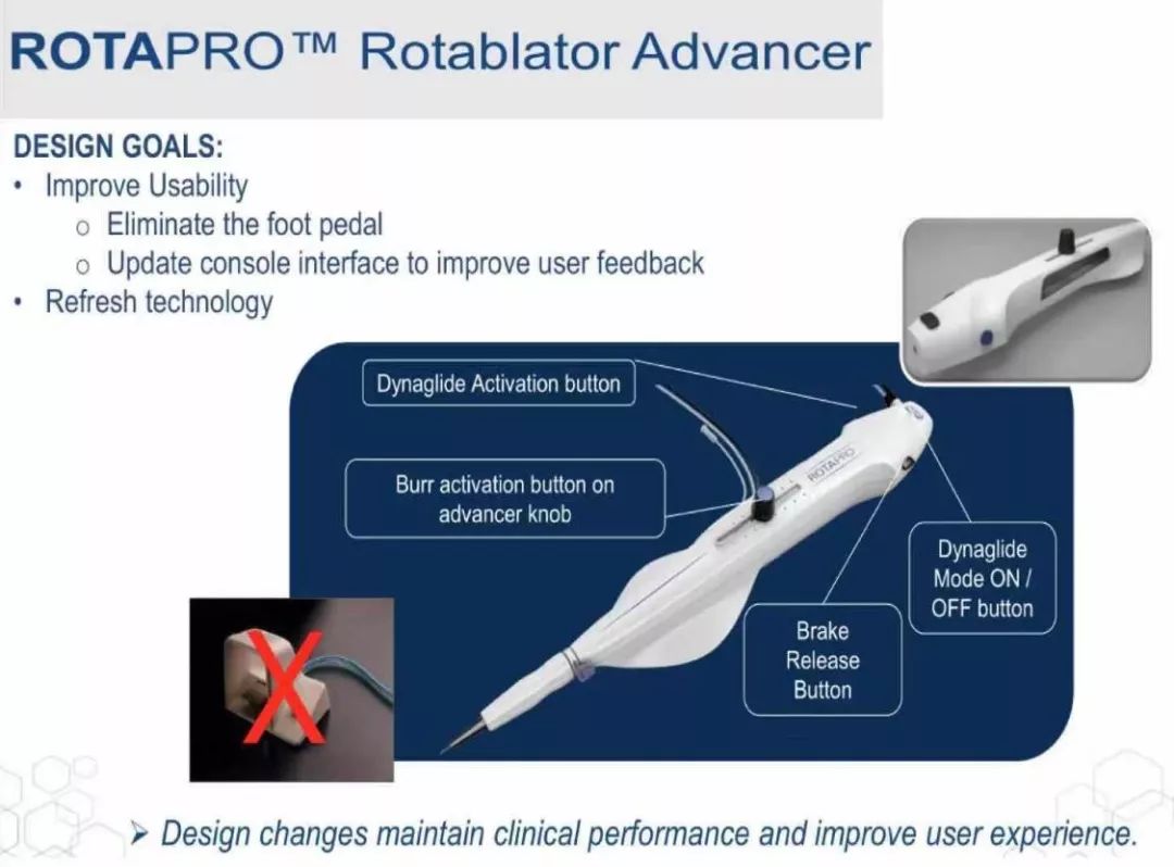 旋磨可以消除钙化吗,准分子激光冠脉钙化斑块消融术