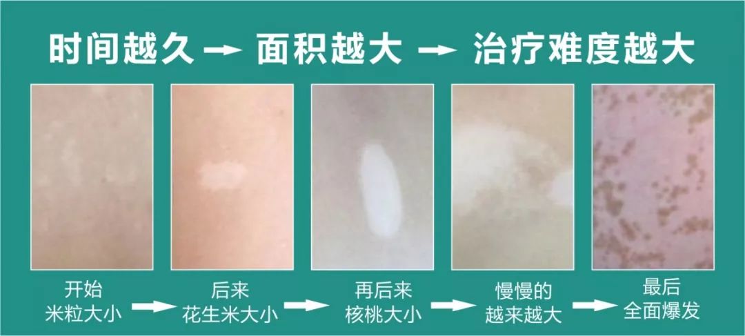 鐧芥枒鏅煡,浜戝崡鐪佺櫧鐧滈鏅煡琛ュ姪