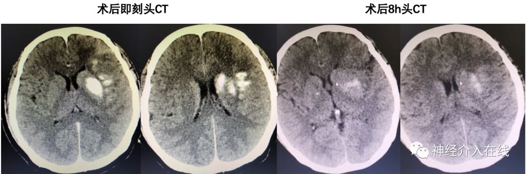 旭日东升第三式,旭日东升第三部