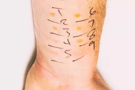 吃桃子拉肚子是怎么回事,夏天吃桃子拉肚子好几天