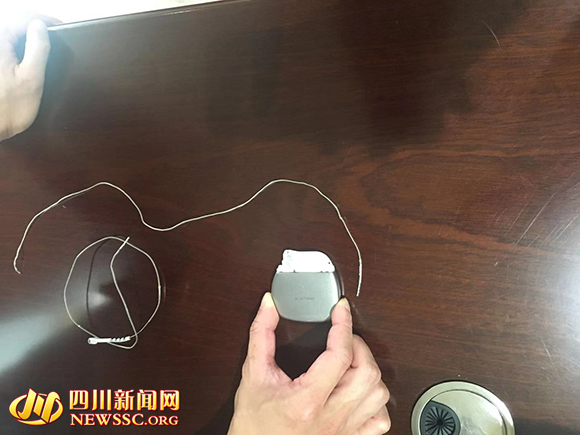 帕金森病可治可控,成都华西医院能治好帕金森病吗