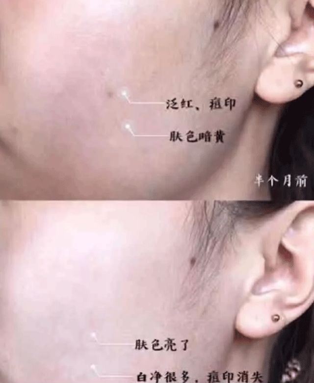 芦荟胶补水保湿提亮肤色晒后修复,万能芦荟胶补水美白修复敏感肌