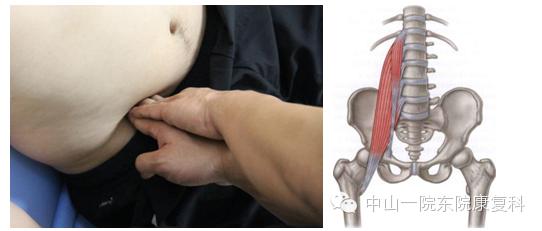康复治疗技术人体解剖学,12条筋膜链解析及治疗手法