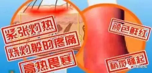 足癣引起丹毒的症状,杏林微科普如何识别癣类疾病