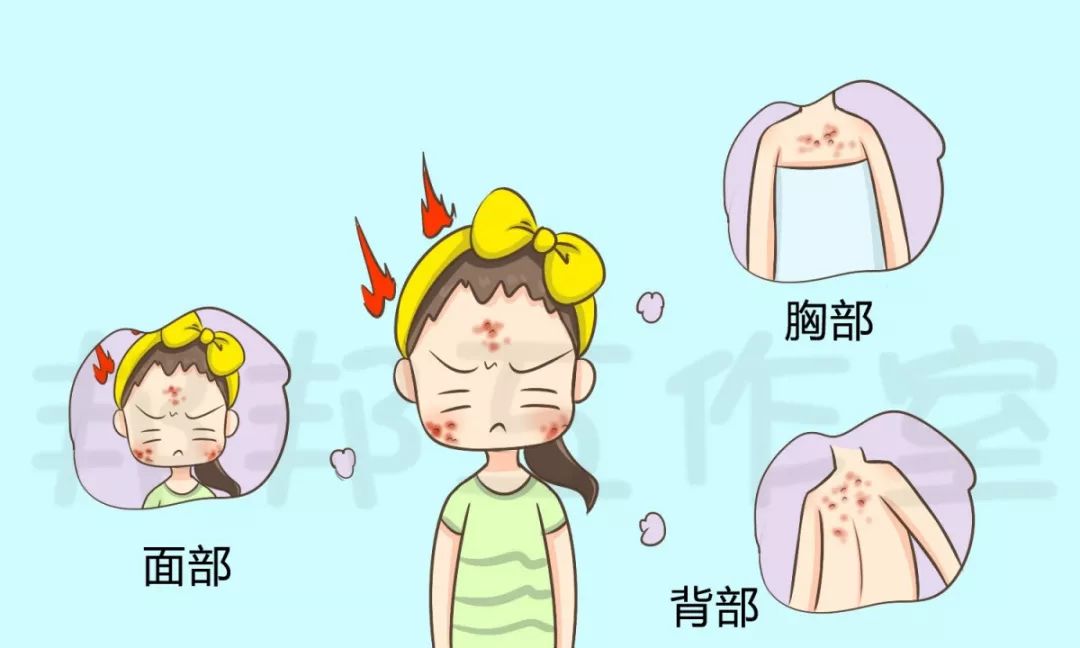 痘痘一直不好怎么办,女生脸上痘痘一直不好