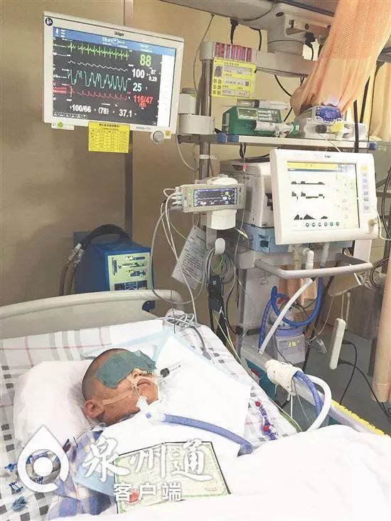 小心毒虫视频,警惕这种虫有人被咬后差点没命