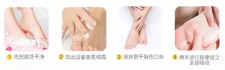 治脚气干裂起皮用什么药膏,有这个方子来治脚气就不怕复发