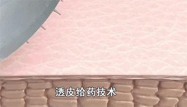 法令纹和眼纹怎么才能有效改善,法令纹贴眼贴有用吗