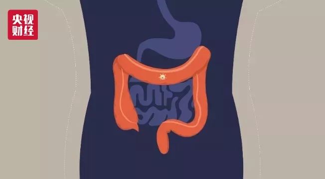 肺癌、胃癌、肝癌，如何体检才能早发现八大高发癌症？