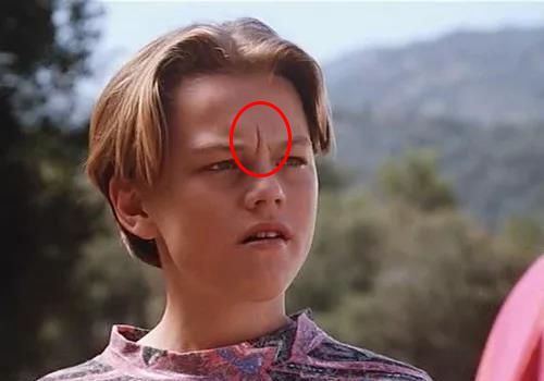 三十岁就有眉间纹法令纹怎么办,30岁法令纹眉心纹深