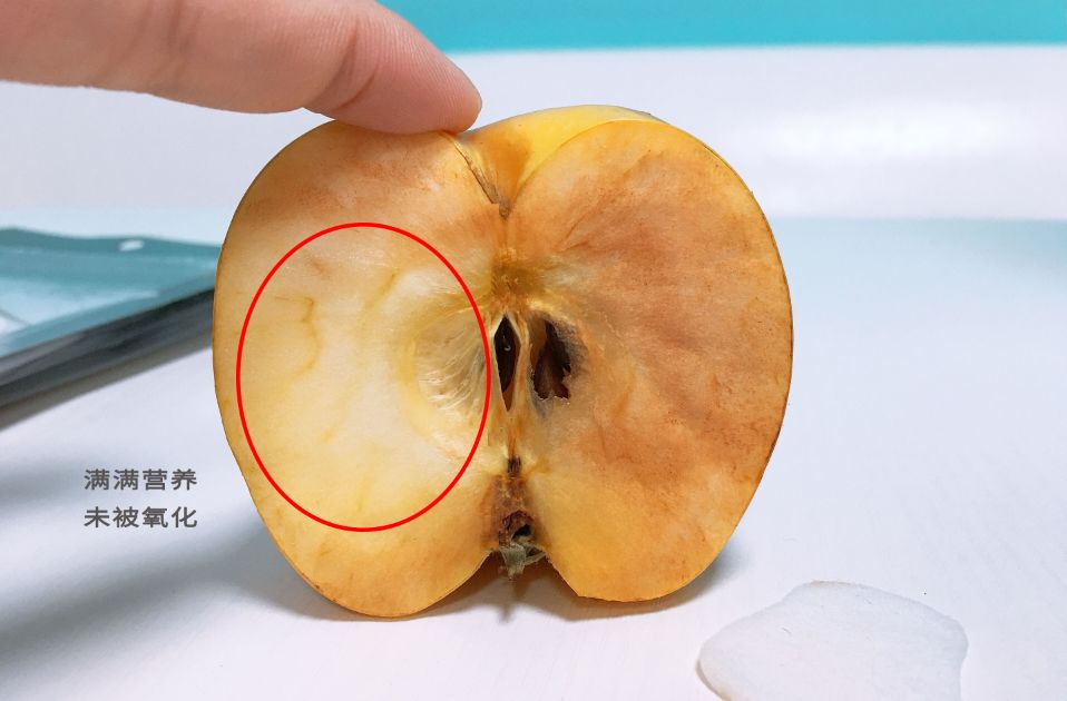 眉间纹和法令纹除皱针能去掉吗,嘴角纹法令纹抬头纹国货推荐