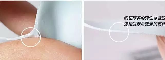 35岁了法令纹鱼尾纹眉间纹怎么办,三十岁就有眉间纹法令纹怎么办