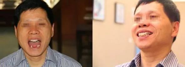 福州市民凭身份证免费牙齿矫正,身份证520开头免票