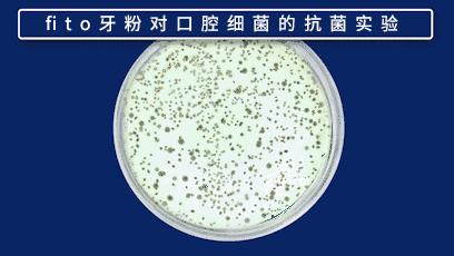 俄罗斯牙膏美白去口臭牙黄,去牙垢黄牙的牙膏测评