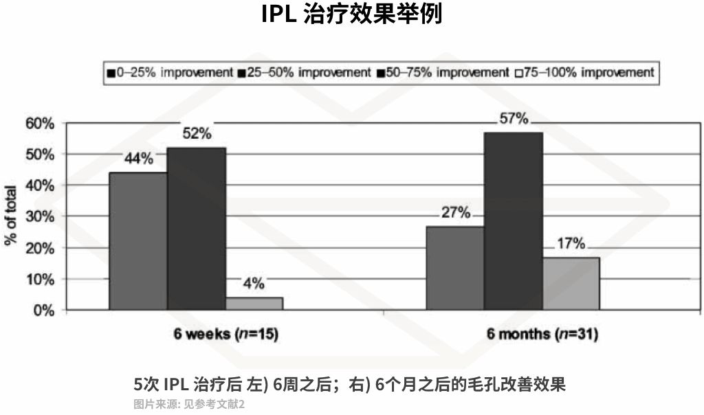 十几年的痘坑毛孔粗大,毛孔粗大不可逆别慌还有救